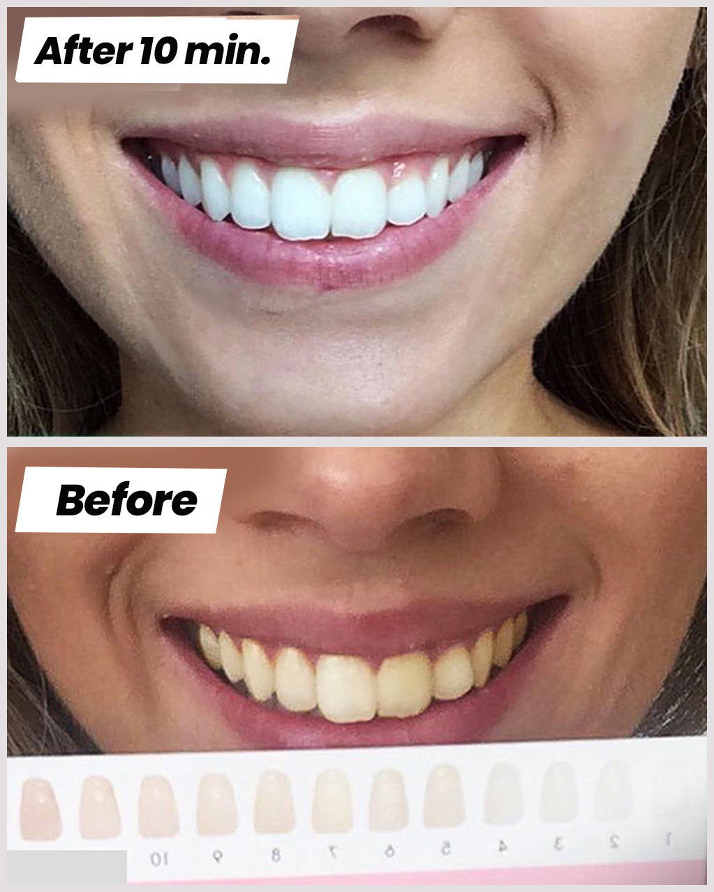 Teeth Whitening Strips™ - clicksmile.net 